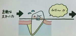 矯正でなぜ歯は動くのか❹