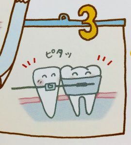 矯正でなぜ歯は動くのか❻