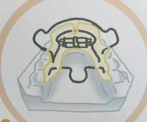 ファンクショナルアプライアンス