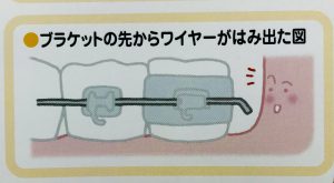 装置の種類としくみ❶