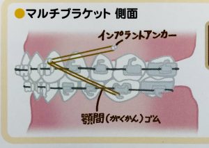 ワンポイントコラム