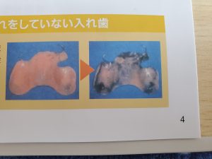 入れ歯のケア